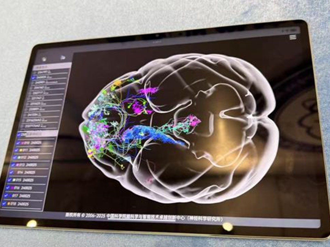 脑图谱大科学计划时机已来！中国科学家十项成果给大脑绘高清地图